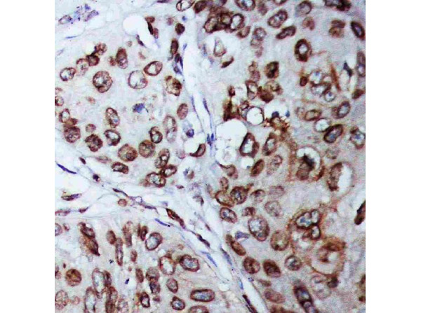 Immunohistochemistry analysis of Lamin B1